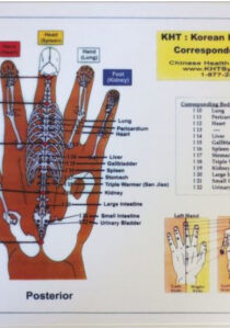 A diagram of the palm of an individual.