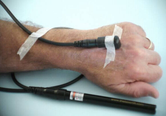 acupuncture-laser-fiber-optic-kit-point-stinulation-hand