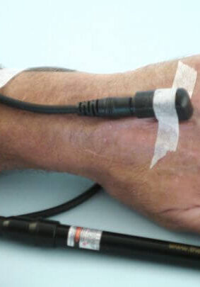 A person with an electric shock cord attached to their arm.